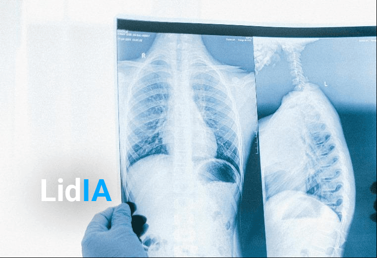 CCSS implementa novedoso sistema para mayor precisión en diagnósticos pulmonares